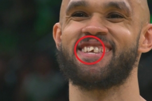 开云体育下载-小白谈去年总决赛被打门牙：之后我进了三分 是我最美好回忆之一